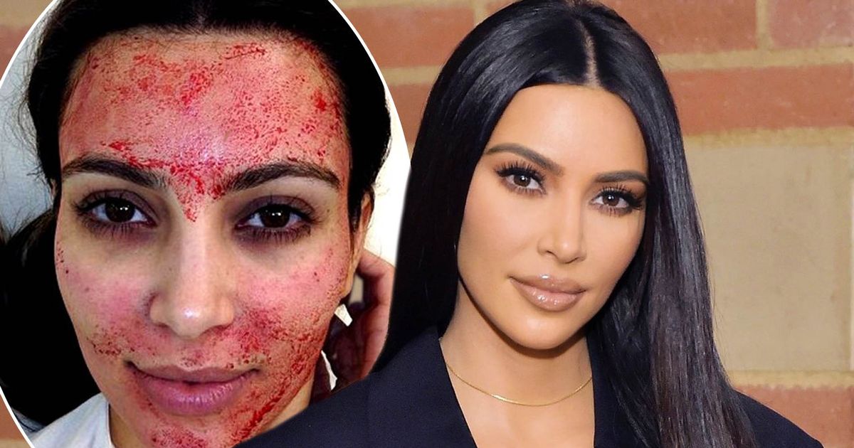 Kim Kardashian sues Vampire Facial doctor for 'using her name and likeness to promote business' - www.ok.co.uk - Miami