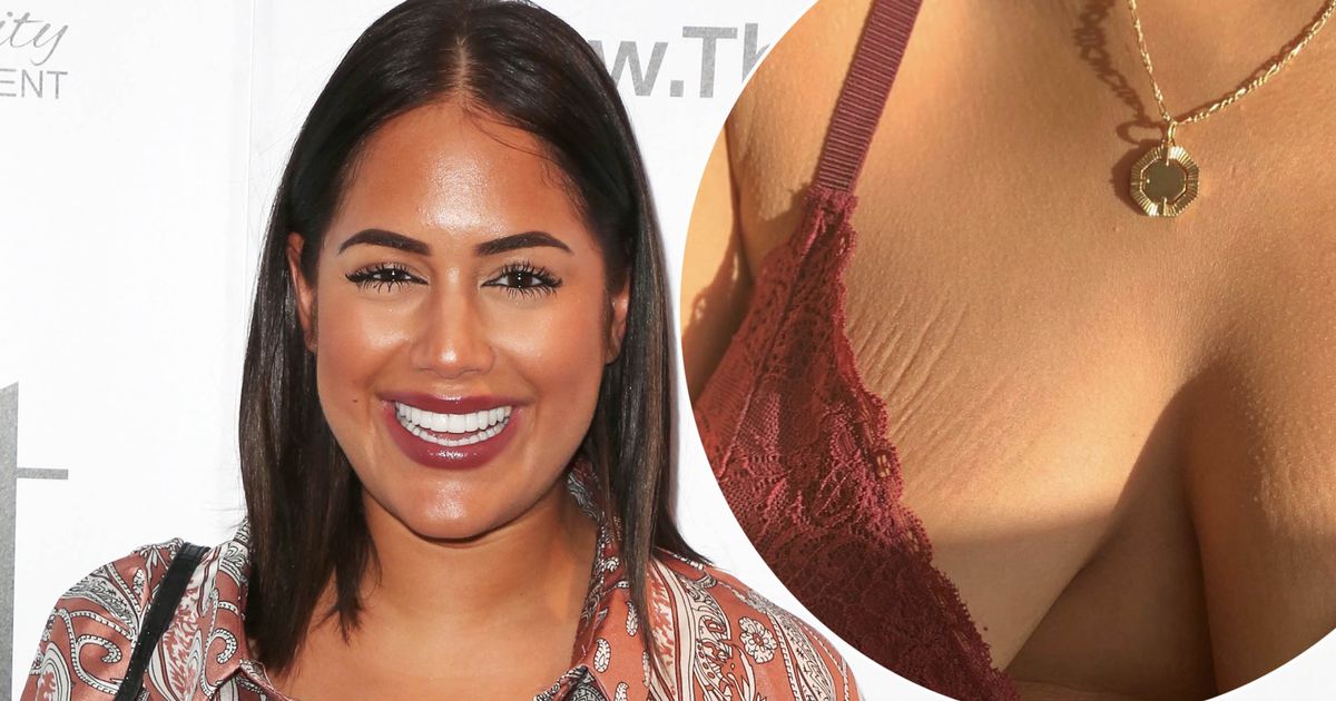 Malin Andersson proudly shows off stretch marks on her breasts as she remembers late daughter - www.ok.co.uk