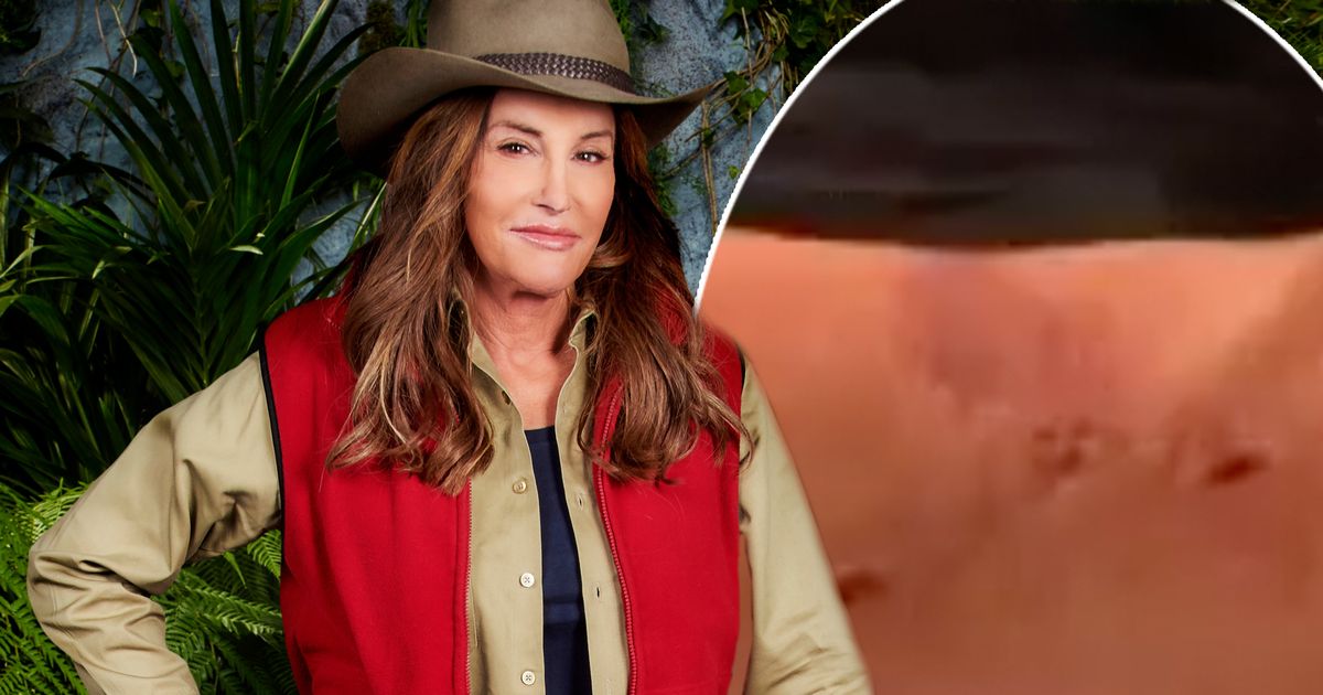 Caitlyn Jenner sparks concern she is still nursing bug bites from I'm A Celebrity jungle - www.ok.co.uk
