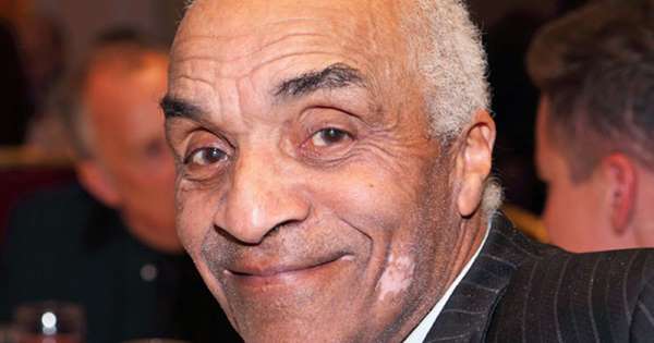 Kenny Lynch, Singer And Variety Performer, Has Died, Aged 81 - www.msn.com - Britain
