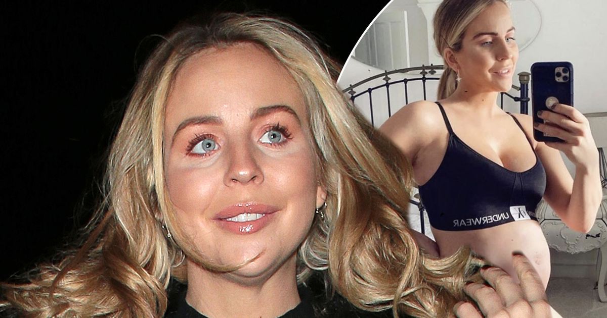 Lydia Bright insists she’s accepted her stretch marks but wants to ‘prevent having more’ - www.ok.co.uk