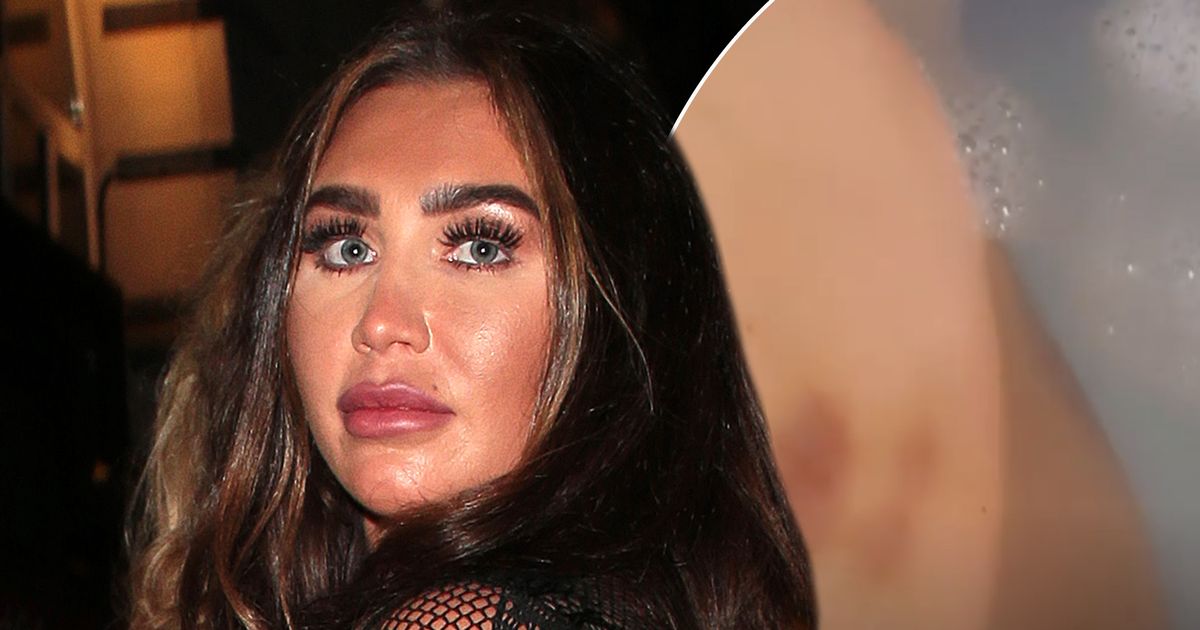 Lauren Goodger reveals bruises in the bath and cancels New Year's Eve plans after hospital dash - www.ok.co.uk