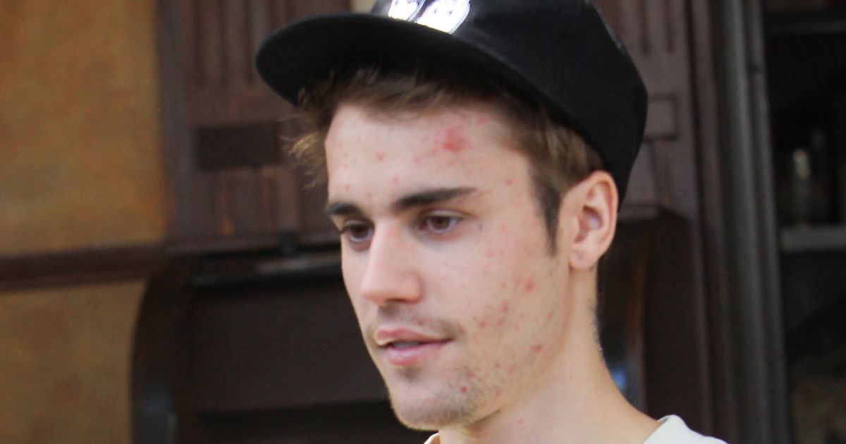 What is Lyme disease, the illness Justin Bieber has revealed he suffers from? - www.ok.co.uk
