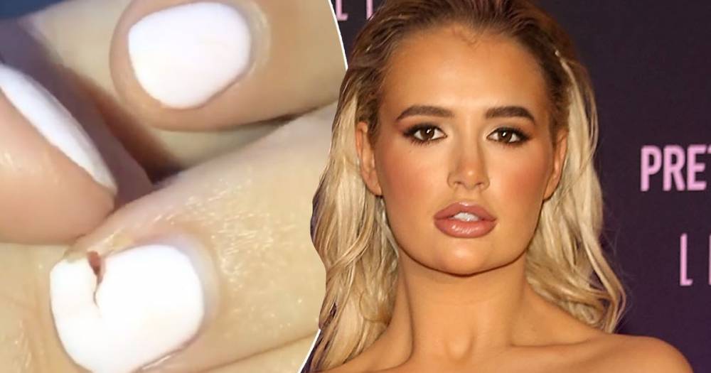 Love Island star Molly-Mae Hague shows painful-looking broken nail after taking acrylics off - www.ok.co.uk - Hague