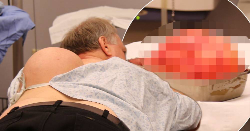 Dr Pimple Popper removes biggest lipoma in show's history as farmer's lump weighs 12lbs - www.ok.co.uk