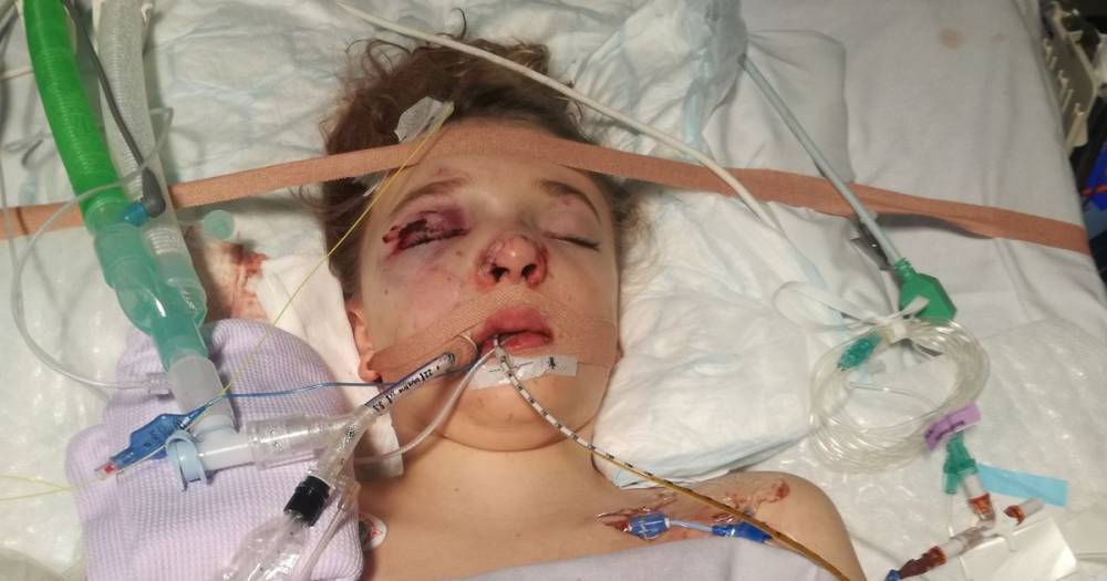 Schoolgirl wants everyone to see picture of her in coma after horror crash with drink-driver that killed her mum - www.dailyrecord.co.uk