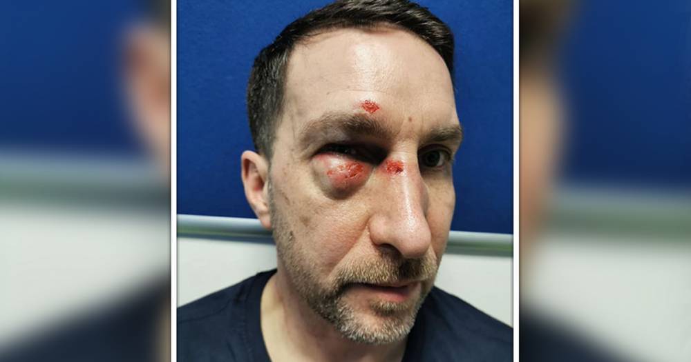 'I realised I had a gun pointing at my head': Man left with horror injuries after he and fiancée are caught up in terrifying Ebay car scam - www.manchestereveningnews.co.uk - county Norfolk