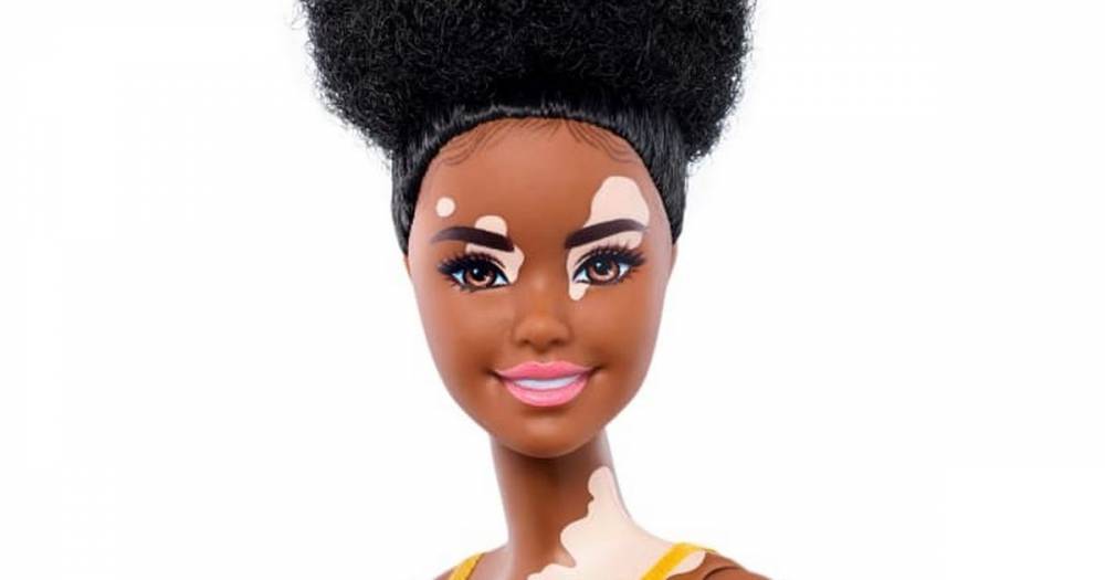 Barbie release new diversity dolls with no hair and vitiligo - www.ok.co.uk