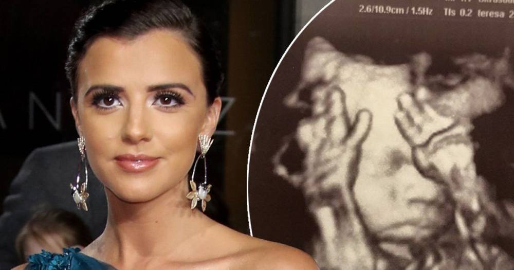 Lucy Mecklenburgh shares extremely clear 4D baby scan of unborn son as she prepares to give birth - www.ok.co.uk