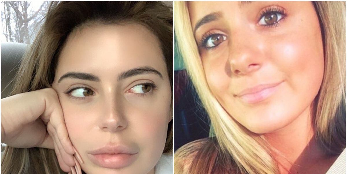 Brielle Biermann Looks So Different After Dissolving All Her Lip Fillers - www.cosmopolitan.com