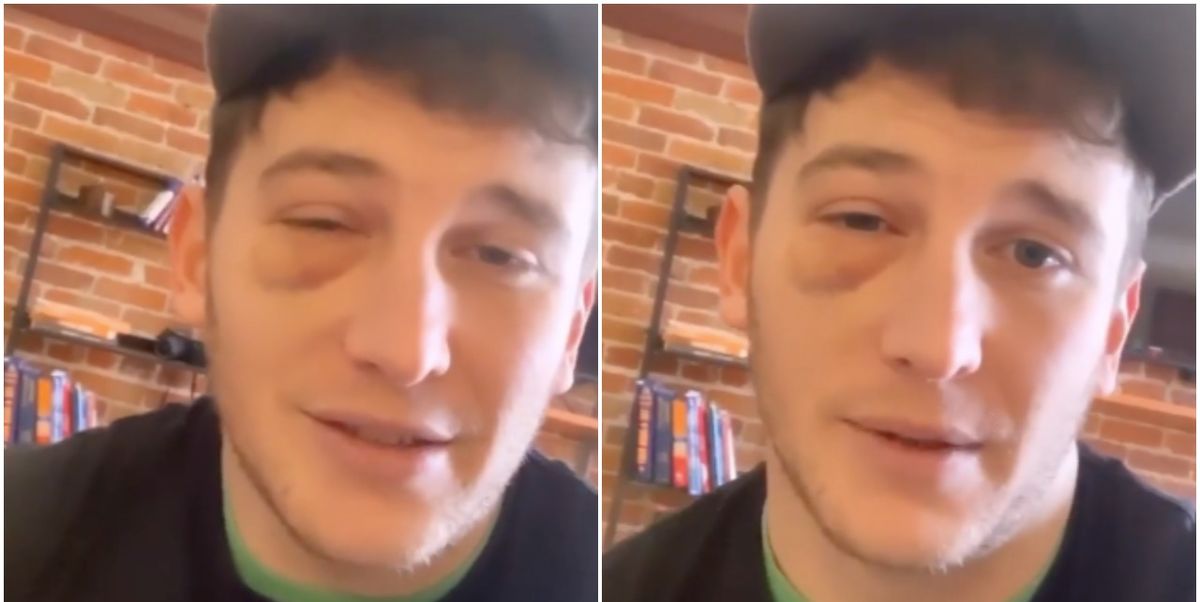 Blake Horstmann Was Punched in the Face By Some Random and Might Need Surgery - www.cosmopolitan.com - New York