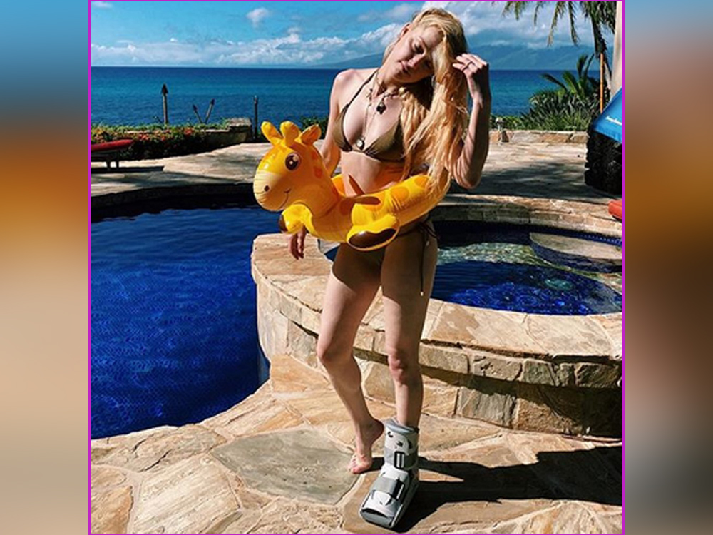 'BOOTY-LICIOUS': Amber Heard's bikini game not hampered by injury - torontosun.com - Hawaii