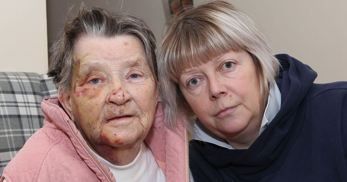 Terrified and bleeding Scots granny with dementia found face down on road a mile away from care home - www.dailyrecord.co.uk - county Ross - Indiana