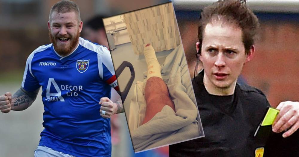 Stunned Scots footballer has surgery carried out by REFEREE - www.dailyrecord.co.uk - Scotland