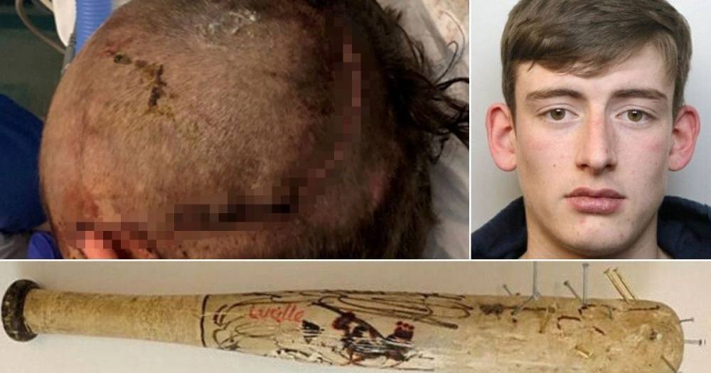 Thug left teenager disabled after attacking him with 'Walking Dead' baseball bat - www.manchestereveningnews.co.uk