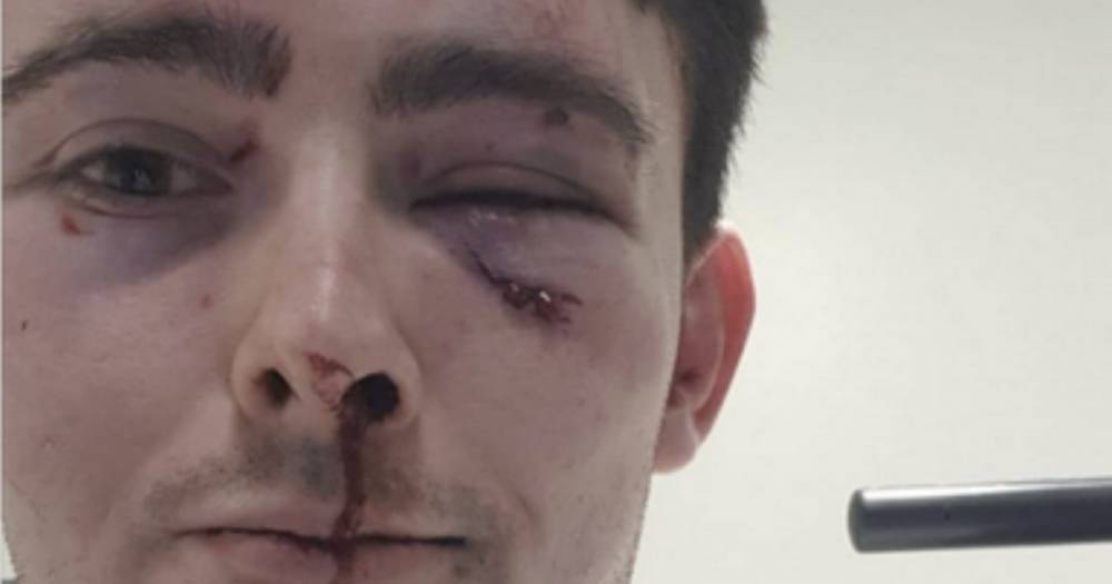 Bartender left with fractured eye sockets after being jumped by two thugs in Glasgow - www.dailyrecord.co.uk