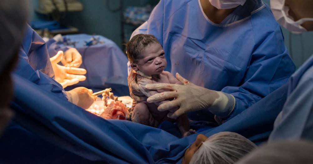 Newborn Baby Goes Viral for Making Hilarious Facial Expression Immediately After C-Section - flipboard.com - Brazil