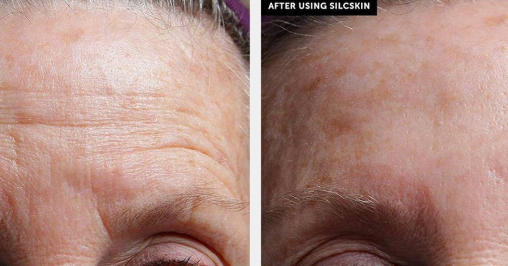 Sleep Your Wrinkles Away With These Professional Smoothing Patches - www.usmagazine.com