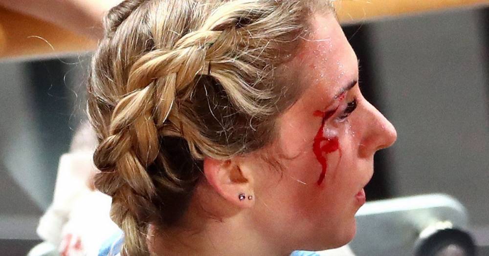 Hard as nails Laura Kenny keeps on cycling after nasty crash, having already suffered a broken shoulder - www.manchestereveningnews.co.uk - Manchester - Berlin