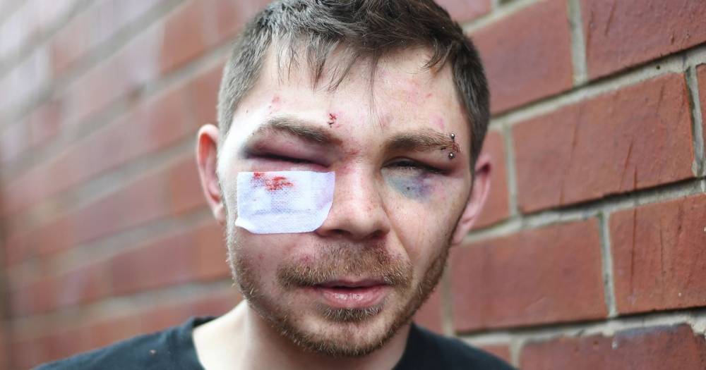 Man describes horrific attack by thugs who threatened him with a hammer in a ginnel as he cycled home from work - www.manchestereveningnews.co.uk