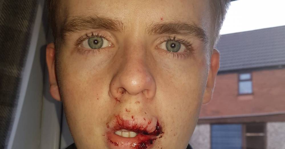 Young man 'covered in blood' after being attacked on his way home from a night out in Bolton - www.manchestereveningnews.co.uk - city Bolton