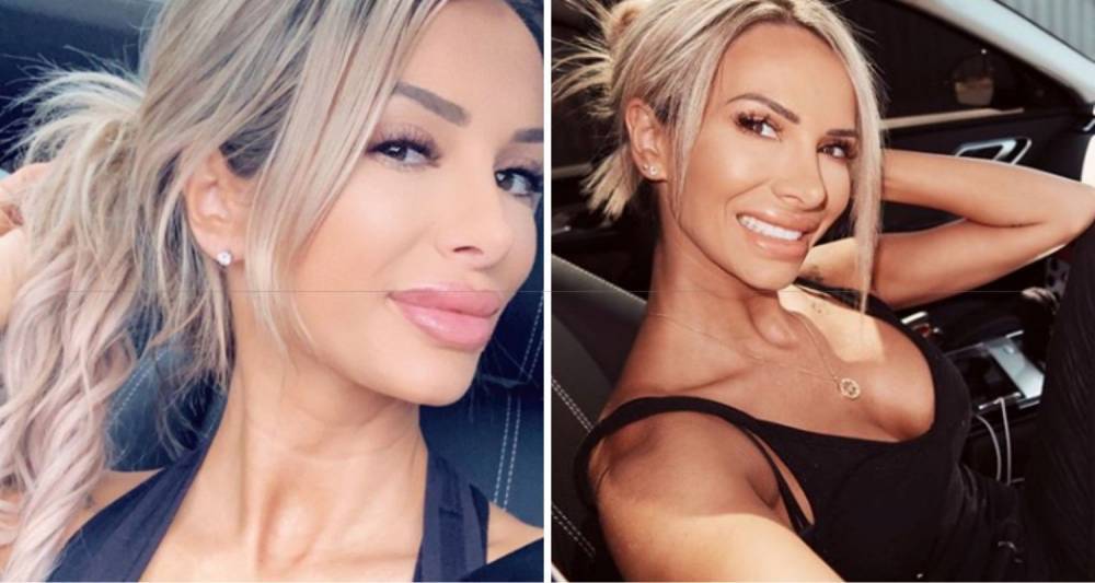 MAFS' Stacey opens up about the "worst" cosmetic producer she's undergone - www.who.com.au