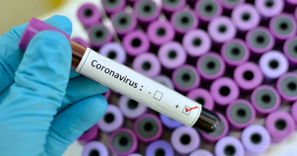 UK coronavirus death toll jumps to 578 as pandemic claims a further 115 victims - www.dailyrecord.co.uk - Britain