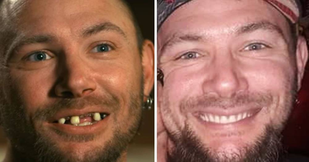 ‘Tiger King’s’ John Finlay Nearly Breaks the Internet by Flashing Pearly White Dentures on Social Media — See the Before and After Pics - www.usmagazine.com