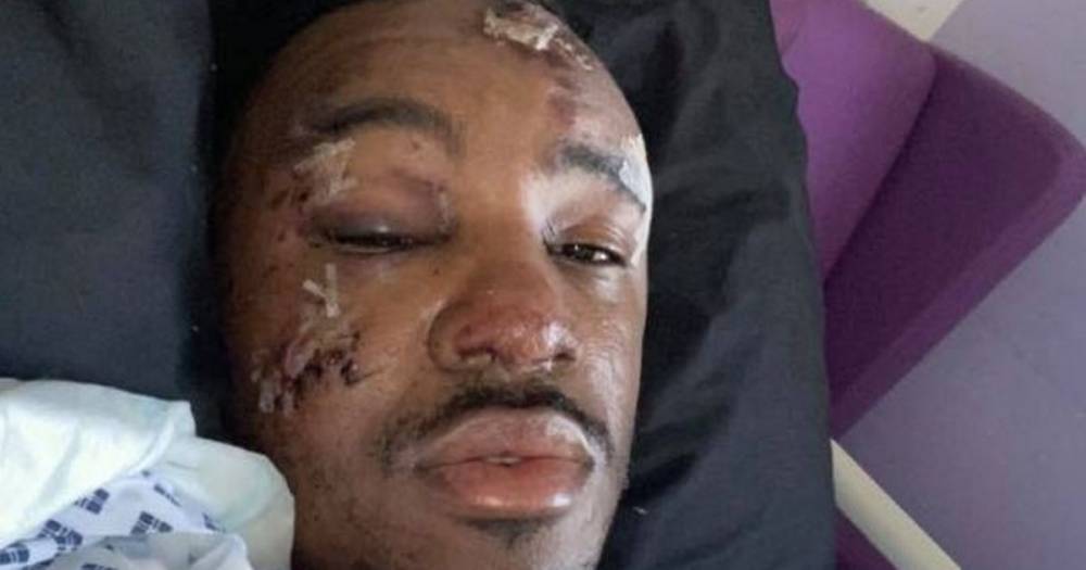 Bugzy Malone says he is 'lucky to be alive' as grime star shares hospital pictures after bike crash - www.manchestereveningnews.co.uk