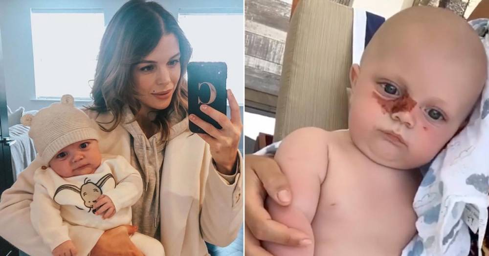 Chloe Lewis shares video of baby son Beau's allergic reaction to sun cream after admitting she feels like 'the worst mum ever' - www.ok.co.uk - Mauritius
