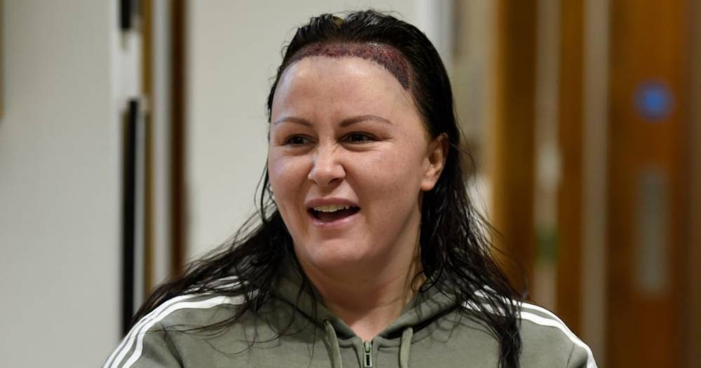 Chanelle Hayes’ surgeon opens up on her £7,500 hair transplant after years of yo-yo dieting left it 'thin and horrendous' - www.ok.co.uk