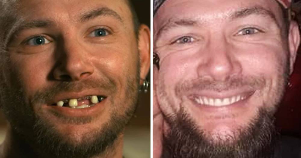 Tiger King’s John Finlay Shares Details About His New Teeth: ‘It Hurt Worse Than My 50-Something Tattoos’ - www.usmagazine.com