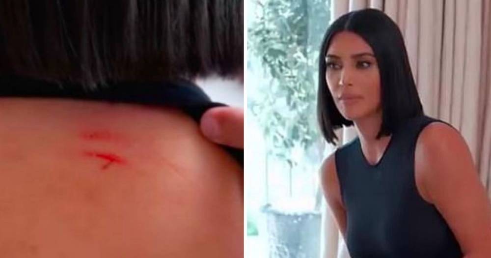 Kim Kardashian shows off bloody cuts after shocking fight with sister Kourtney turns physical - www.ok.co.uk