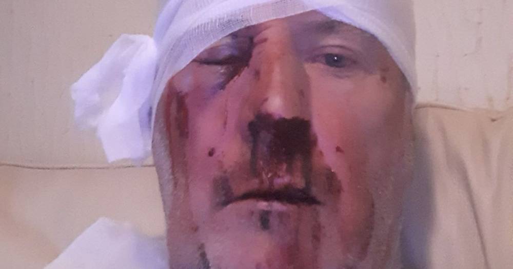 Scots bin lorry driver stabbed in head and battered to pulp after tackling yobs throwing buckets in old lady's garden - www.dailyrecord.co.uk - Scotland