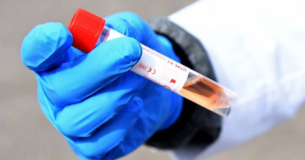UK coronavirus death toll rises by 763 in 24 hours - www.manchestereveningnews.co.uk - Britain