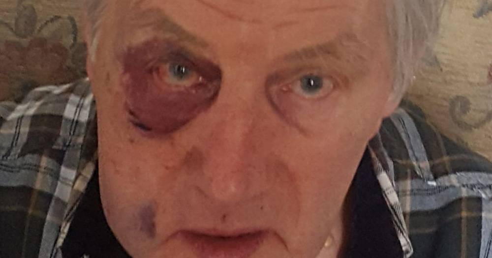 Pensioner left with dislocated jaw and fractured eye socket after being battered through car window on country road - www.dailyrecord.co.uk