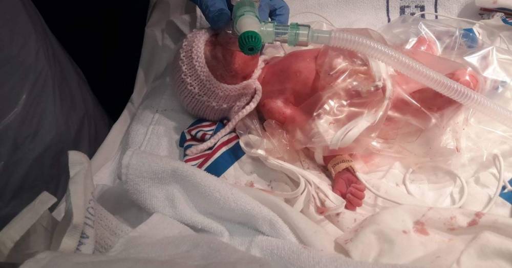 Mum of Scots tot born weighing less than 3lbs urges people to 'stay at home' - www.dailyrecord.co.uk - Scotland