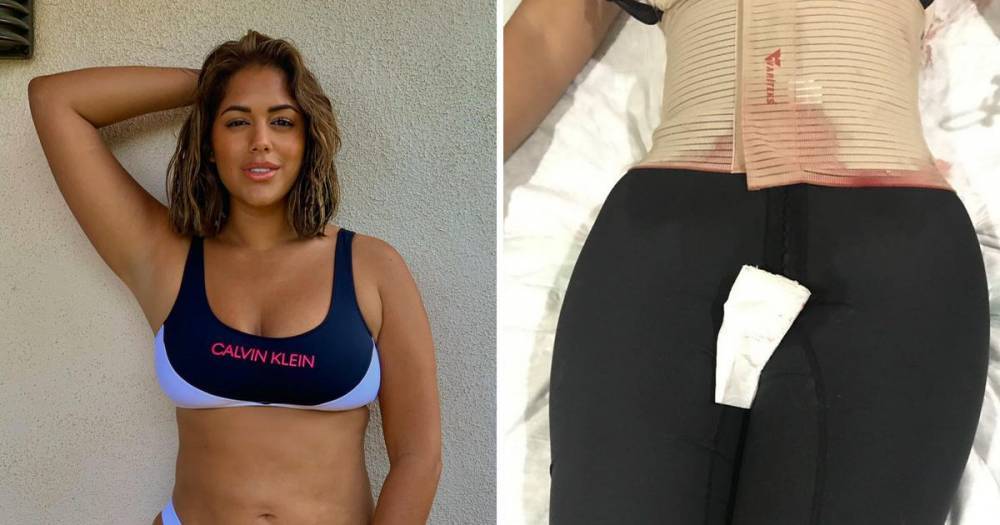 Malin Andersson regrets painful cosmetic surgeries and says she was 'young and naive' before breast uplift and bum lift - www.ok.co.uk - Brazil - Turkey