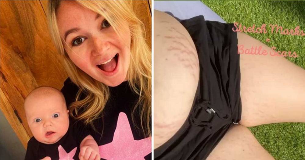 EastEnders star Melissa Suffield proudly flaunts stretch marks after birth of son and hits back at trolls - www.ok.co.uk