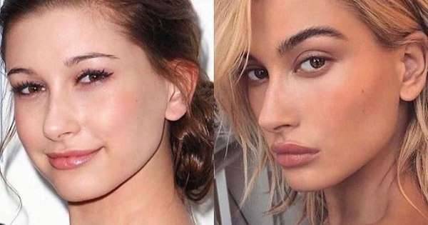 Hailey Bieber - Hailey Bieber responds to plastic surgery rumor after ‘crazy’ transformation picture is posted - msn.com