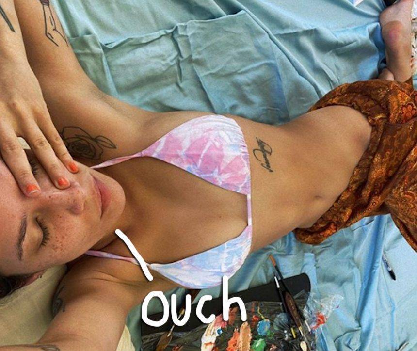 Halsey Reveals The HIGHlariously Bizarre Way She Fractured Her Ankle! - perezhilton.com