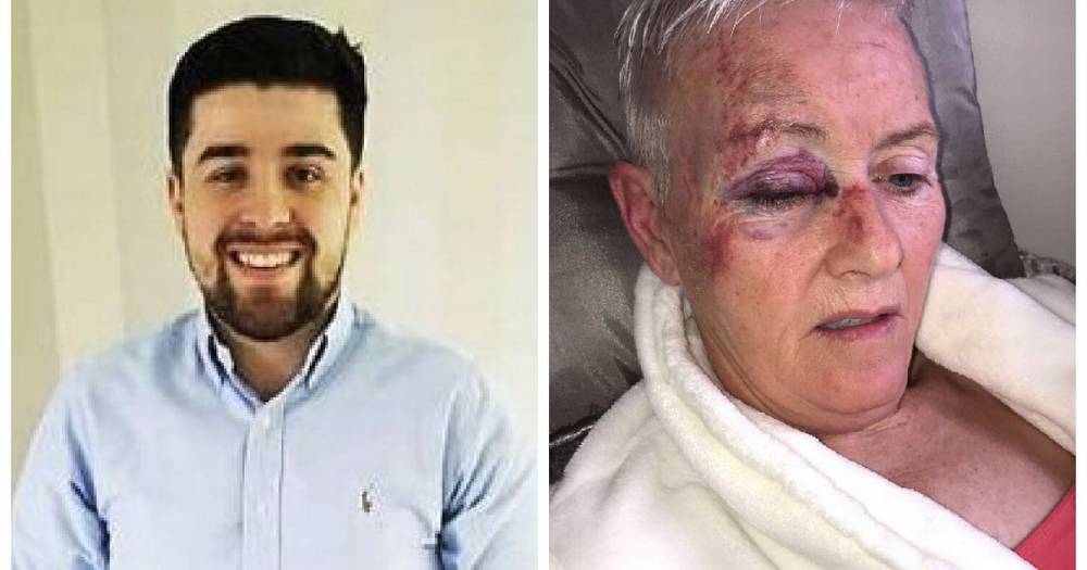 Gran battered by workmate during rammy at wake in East Kilbride pub - www.dailyrecord.co.uk - county Richardson