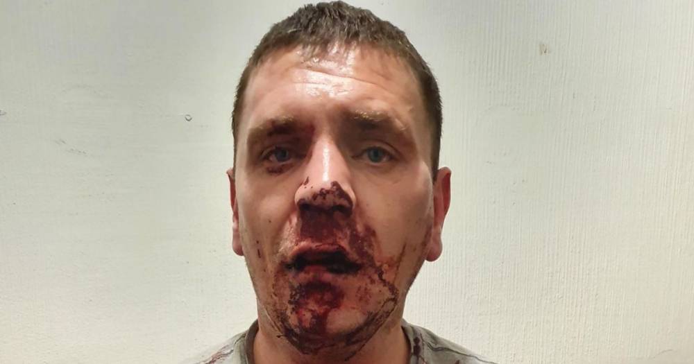 Dad left with horrific facial injures after being viciously attacked outside hotel - www.manchestereveningnews.co.uk - Manchester