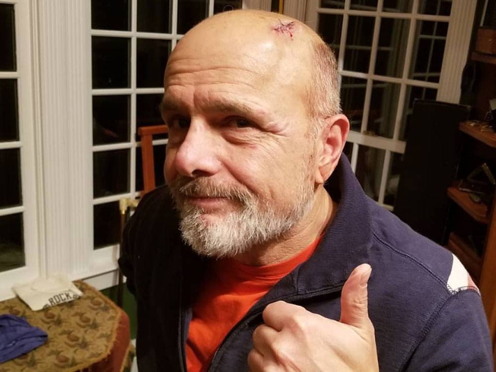 Joe Pantoliano recovering at home from severe head injury - torontosun.com - state Connecticut