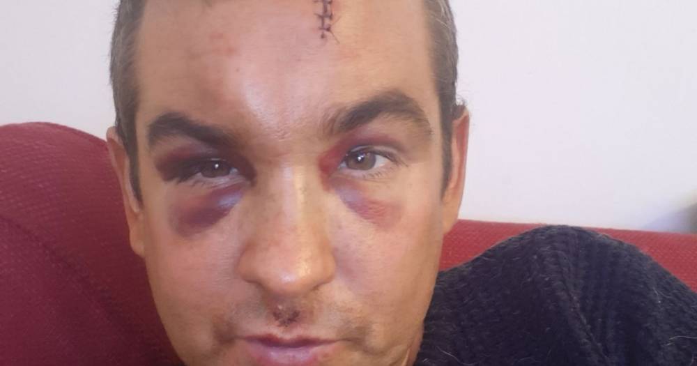 Paisley man suffers horrific injuries after being beaten by a gang outside his flat - www.dailyrecord.co.uk - county Brown