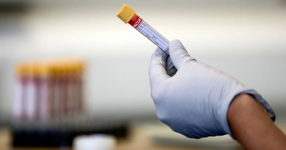 UK coronavirus death toll rises by 77 - www.manchestereveningnews.co.uk - Britain