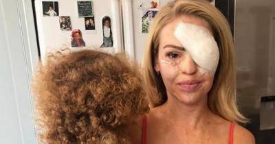 Katie Piper praised as she shares unseen photos following acid attack to show how far she’s come - www.ok.co.uk