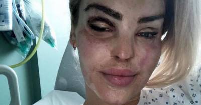 Katie Piper posts selfie from hospital bed after undergoing 400th operation - www.dailyrecord.co.uk