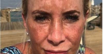 Real Housewives star on her battle with skin pigmentation after she and identical twin both developed dark marks on their faces - www.manchestereveningnews.co.uk