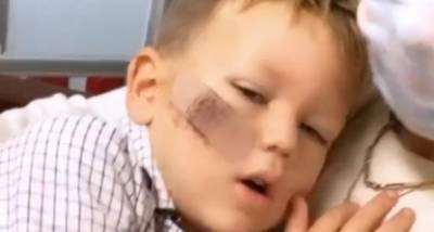 Armie Hammer and Elizabeth Chambers' son receives numerous stitches after a horrible fall from the bed - www.pinkvilla.com - county Chambers